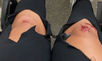 Passageiros ficam feridos após pane em avião que sairia de MT para São Paulo