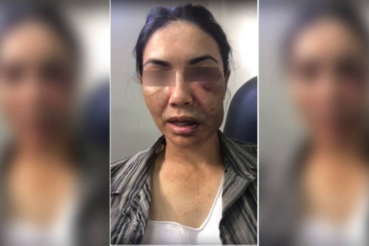 Adolescentes suspeitos de espancar e assaltar motorista de app são internados em MT