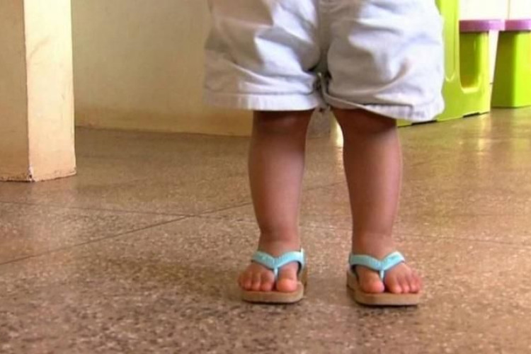 Bebê é internado com fratura no fêmur em MT; mãe é suspeita