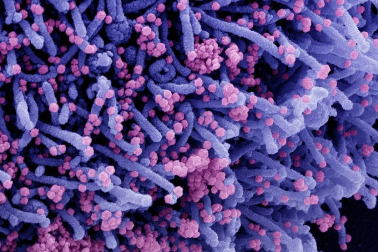 Casos de covid-19 batem recorde na Europa próximo à chegada do inverno