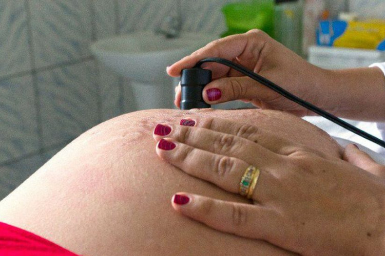 Covid-19: mortalidade de gestantes é mais que o dobro da média no país