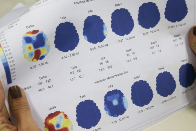 Março Roxo quer conscientizar população sobre a epilepsia