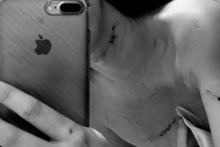 Mulher que denunciou jogador do Cuiabá por agressão em motel posta foto de ferimentos