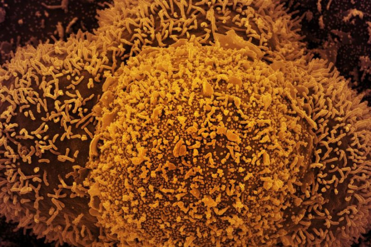 Saúde confirma primeiro caso de subvariante da Ômicron no país